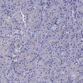 Anti-STAR antibody produced in rabbit Prestige Antibodies® Powered by Atlas Antibodies, affinity isolated antibody, buffered aqueous glycerol solution, ab2