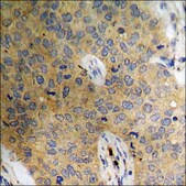 Anti-phospho-Catenin-β (pSer37) antibody produced in rabbit affinity isolated antibody