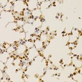 Anti-S100A4 antibody produced in rabbit