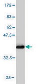 Monoclonal Anti-STAR antibody produced in mouse clone 5F9, purified immunoglobulin, buffered aqueous solution