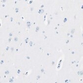 Anti-MFAP5 antibody produced in rabbit Prestige Antibodies® Powered by Atlas Antibodies, affinity isolated antibody, buffered aqueous glycerol solution