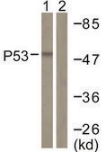 Anti-p53 antibody produced in rabbit affinity isolated antibody