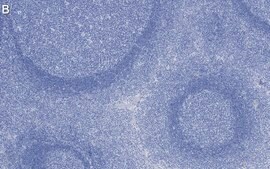 Anti-Talin-1 Antibody, clone 2F8 ZooMAb® Rabbit Monoclonal recombinant, expressed in HEK 293 cells