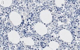 Anti-UTX Antibody, clone 4G9 ZooMAb® Rabbit Monoclonal recombinant, expressed in HEK 293 cells