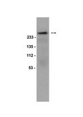 Anti-phospho-Acetyl CoA Carboxylase (Ser79) Antibody Upstate®, from rabbit