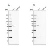 Anti-FTCD antibody produced in rabbit Prestige Antibodies® Powered by Atlas Antibodies, affinity isolated antibody, buffered aqueous glycerol solution
