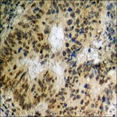 抗-磷酸化-Mst1/2 (pThr183) 兔抗 affinity isolated antibody