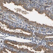 Anti-IQGAP1 antibody produced in rabbit Prestige Antibodies® Powered by Atlas Antibodies, affinity isolated antibody, buffered aqueous glycerol solution