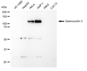 Anti Desmocollin 3 Antibody, clone 23GB1200, Rabbit Monoclonal clone 23GB1200, recombinant rabbit monoclonal, expressed in HEK293 cells