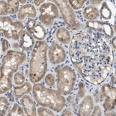 Anti-SNX14 antibody produced in rabbit Prestige Antibodies® Powered by Atlas Antibodies, affinity isolated antibody, buffered aqueous glycerol solution