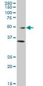 Monoclonal Anti-GATA3 antibody produced in mouse clone 1C1, purified immunoglobulin, buffered aqueous solution