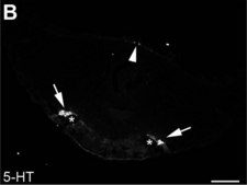 抗-血清素 兔抗 whole antiserum