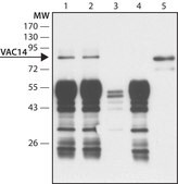Anti-VAC14 antibody produced in rabbit ~1.5 mg/mL, affinity isolated antibody, buffered aqueous solution