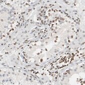 Anti-PRKAG2 antibody produced in rabbit Prestige Antibodies® Powered by Atlas Antibodies, affinity isolated antibody, buffered aqueous glycerol solution