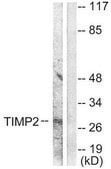 Anti-TIMP2 antibody produced in rabbit affinity isolated antibody