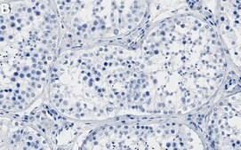 Anti-Ataxin-3 Antibody, clone 2C14 ZooMAb® Rabbit Monoclonal recombinant, expressed in HEK 293 cells