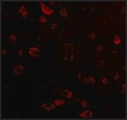 Anti-TIGAR (ab2) antibody produced in rabbit affinity isolated antibody, buffered aqueous solution