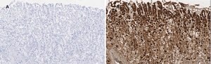 Anti-ALDH1A1 Antibody, clone 4J6, ZooMAb® Rabbit Monoclonal recombinant, expressed in HEK 293 cells