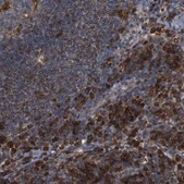 Anti-PTPN1 antibody produced in rabbit Prestige Antibodies® Powered by Atlas Antibodies, affinity isolated antibody, buffered aqueous glycerol solution