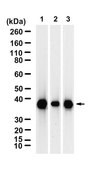 Anti-Claudin-18 Antibody, clone 1G17 ZooMAb® Rabbit Monoclonal recombinant, expressed in HEK 293 cells