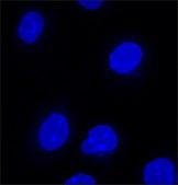 U2OS LMNB1-TUBA1B-ACTB