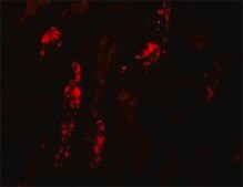 Anti-KANK1 antibody produced in rabbit affinity isolated antibody, buffered aqueous solution