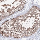 Anti-NCAPD2 antibody produced in rabbit Prestige Antibodies® Powered by Atlas Antibodies, affinity isolated antibody, buffered aqueous glycerol solution