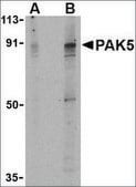 Anti-PAK5 antibody produced in rabbit affinity isolated antibody, buffered aqueous solution
