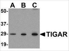 Anti-TIGAR (ab2) antibody produced in rabbit affinity isolated antibody, buffered aqueous solution