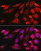 Anti-VCP antibody produced in rabbit