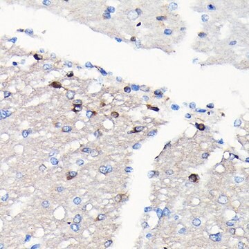 Anti-NMDAR2A antibody produced in rabbit