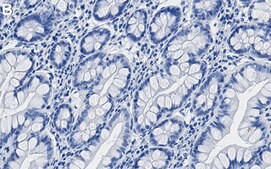 Anti-ALIX/PDCD6IP Antibody, clone 1D11 ZooMAb® Rabbit Monoclonal recombinant, expressed in HEK 293 cells