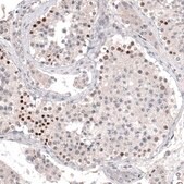 Monoclonal Anti-PRAME antibody produced in mouse Prestige Antibodies® Powered by Atlas Antibodies, clone CL5148, purified immunoglobulin, buffered aqueous glycerol solution