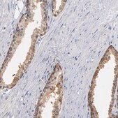 Anti-MIF antibody produced in rabbit Prestige Antibodies® Powered by Atlas Antibodies, affinity isolated antibody, buffered aqueous glycerol solution