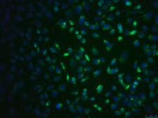 SCp2 Mouse Mammary Epithelial Cell Line