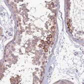 Anti-ITGAE antibody produced in rabbit Prestige Antibodies® Powered by Atlas Antibodies, affinity isolated antibody, buffered aqueous glycerol solution
