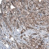 Monoclonal Anti-SMAD2 antibody produced in mouse Prestige Antibodies® Powered by Atlas Antibodies, clone CL8472, purified immunoglobulin, buffered aqueous glycerol solution
