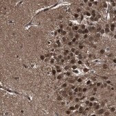 Anti-VCP antibody produced in rabbit Prestige Antibodies® Powered by Atlas Antibodies, affinity isolated antibody, buffered aqueous glycerol solution