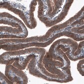 Monoclonal Anti-BRAF antibody produced in mouse Prestige Antibodies® Powered by Atlas Antibodies, clone CL4003, purified immunoglobulin