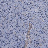 Anti-PARG antibody produced in rabbit Prestige Antibodies® Powered by Atlas Antibodies, affinity isolated antibody, buffered aqueous glycerol solution
