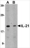 Anti-IL-21 antibody produced in rabbit affinity isolated antibody, buffered aqueous solution