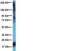 Anti-Phosphothreonine Antibody Chemicon®, from rabbit
