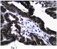 抗Twist1（扭曲相关蛋白1）抗体 from rabbit, purified by affinity chromatography