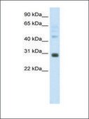 Anti-DLX5 (AB1) antibody produced in rabbit IgG fraction of antiserum