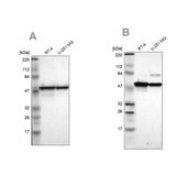 Anti-PDIA3 antibody produced in rabbit Ab2, Prestige Antibodies® Powered by Atlas Antibodies, affinity isolated antibody, buffered aqueous glycerol solution