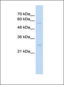 Anti-SOCS1 antibody produced in rabbit IgG fraction of antiserum