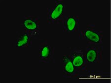 Monoclonal Anti-RNF168 antibody produced in mouse clone 3E1, purified immunoglobulin, buffered aqueous solution