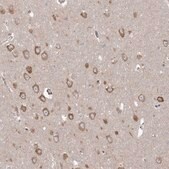 Anti-PPP2R3A antibody produced in rabbit Prestige Antibodies® Powered by Atlas Antibodies, affinity isolated antibody, buffered aqueous glycerol solution