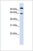 Anti-RUNX1T1 antibody produced in rabbit affinity isolated antibody