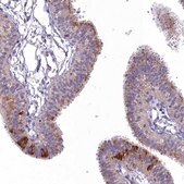 Anti-MICU2 antibody produced in rabbit Prestige Antibodies® Powered by Atlas Antibodies, affinity isolated antibody, buffered aqueous glycerol solution